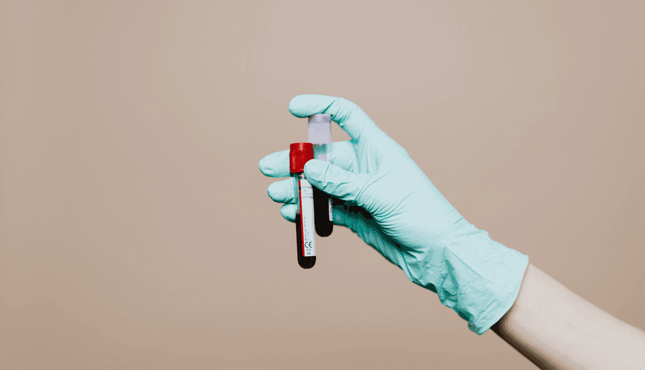 THC: Wirkung, Abbau und Nachweisbarkeit im Blut und Urin