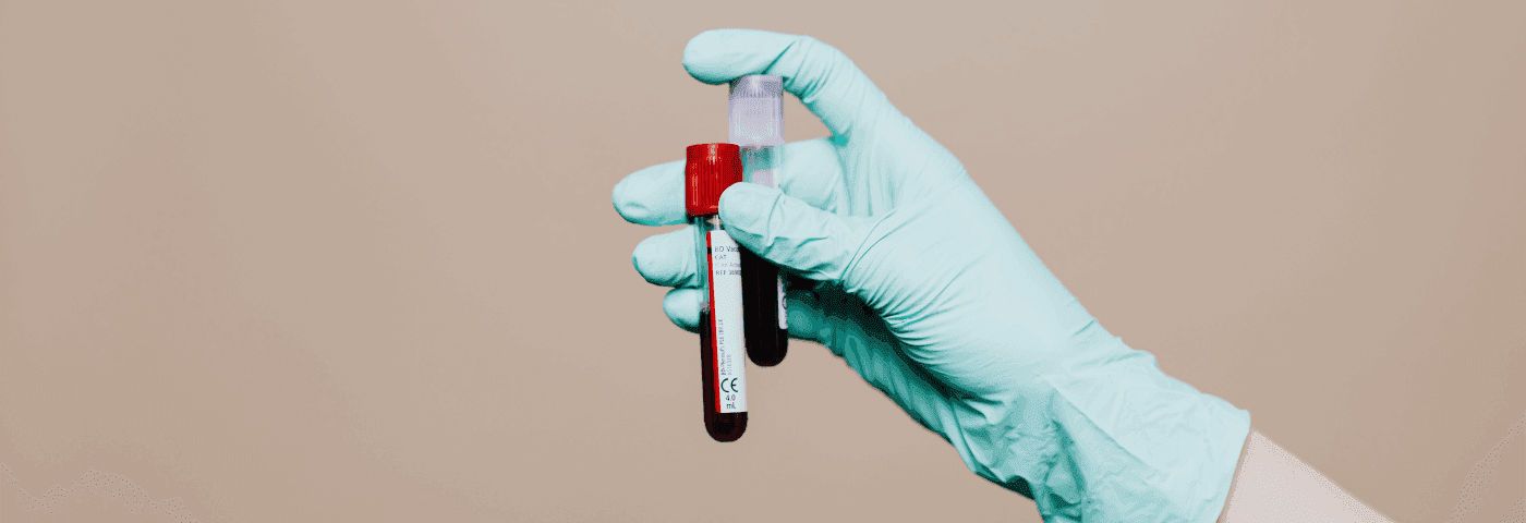 THC: Wirkung, Abbau und Nachweisbarkeit im Blut und Urin